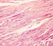 Erster Patient mit AB-1002 in GenePHIT-Studie behandelt (Foto: AdobeStock - Dr_Microbe 172426570)